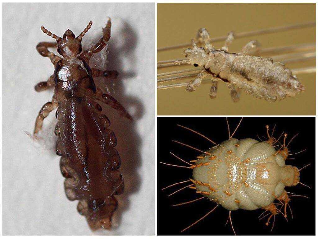 Симптомы наличия бельевых вшей на теле