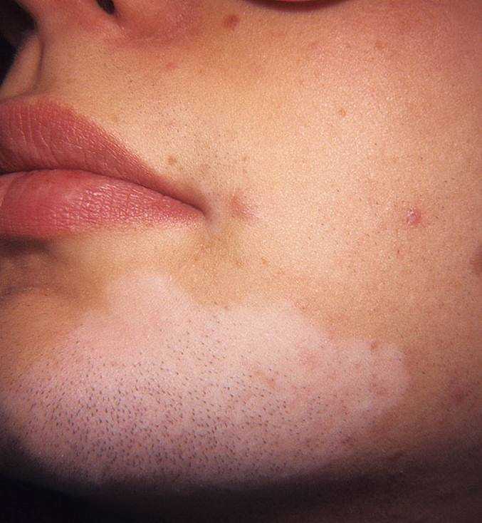 Медикаментозное лечение