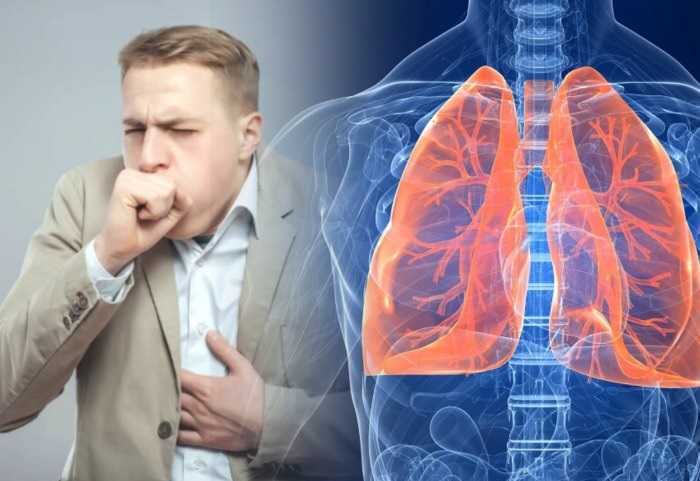 Как очистить легкие после курения: лучшие способы и рекомендации