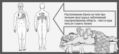 Подготовка к процедуре