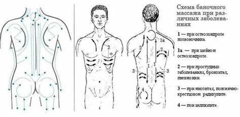 Техника баночного массажа