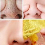 Домашние маски для лица от прыщей и угревой сыпи Домашние маски для лица от прыщей и угревой сыпи